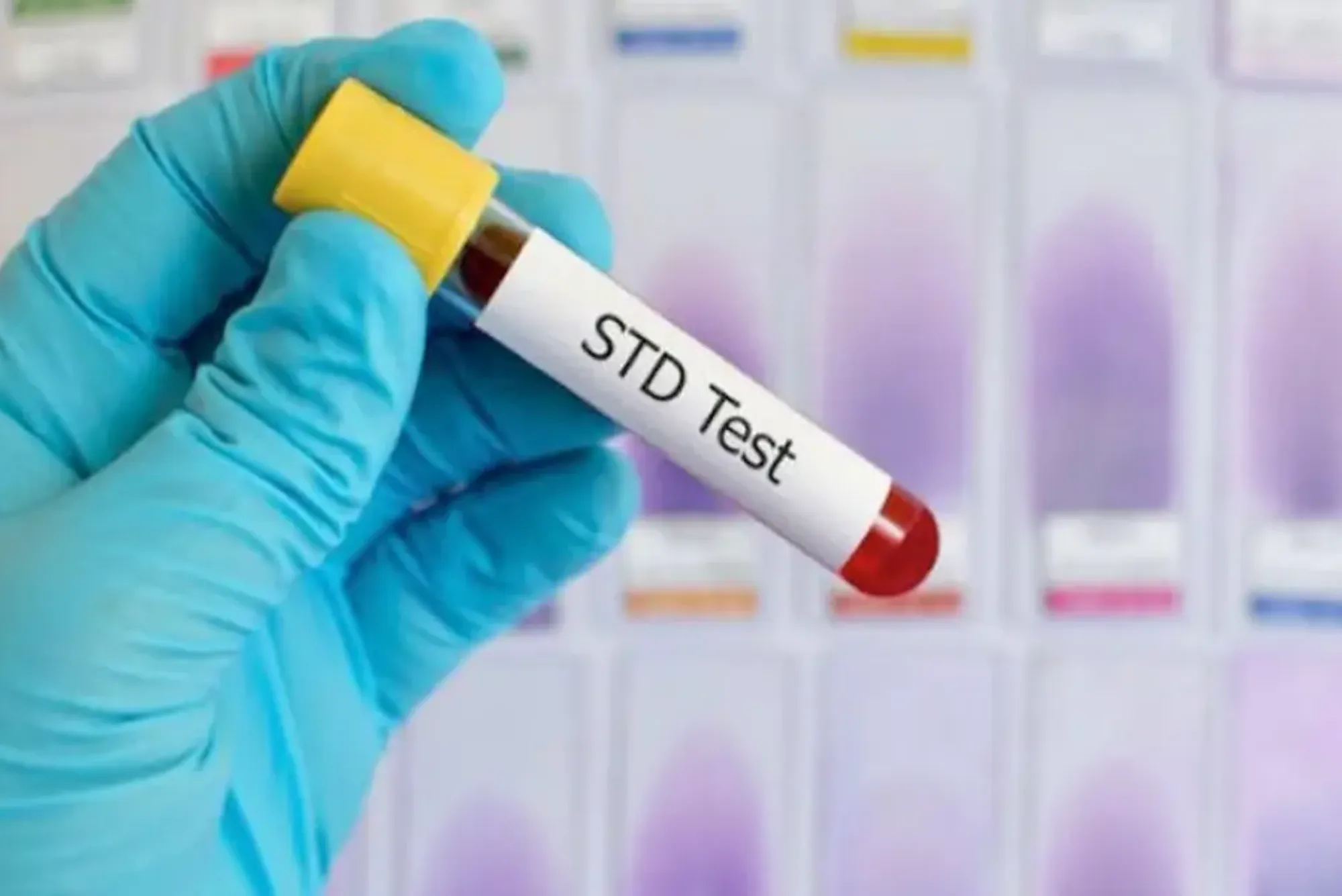 STD Screening at Home in Dubai