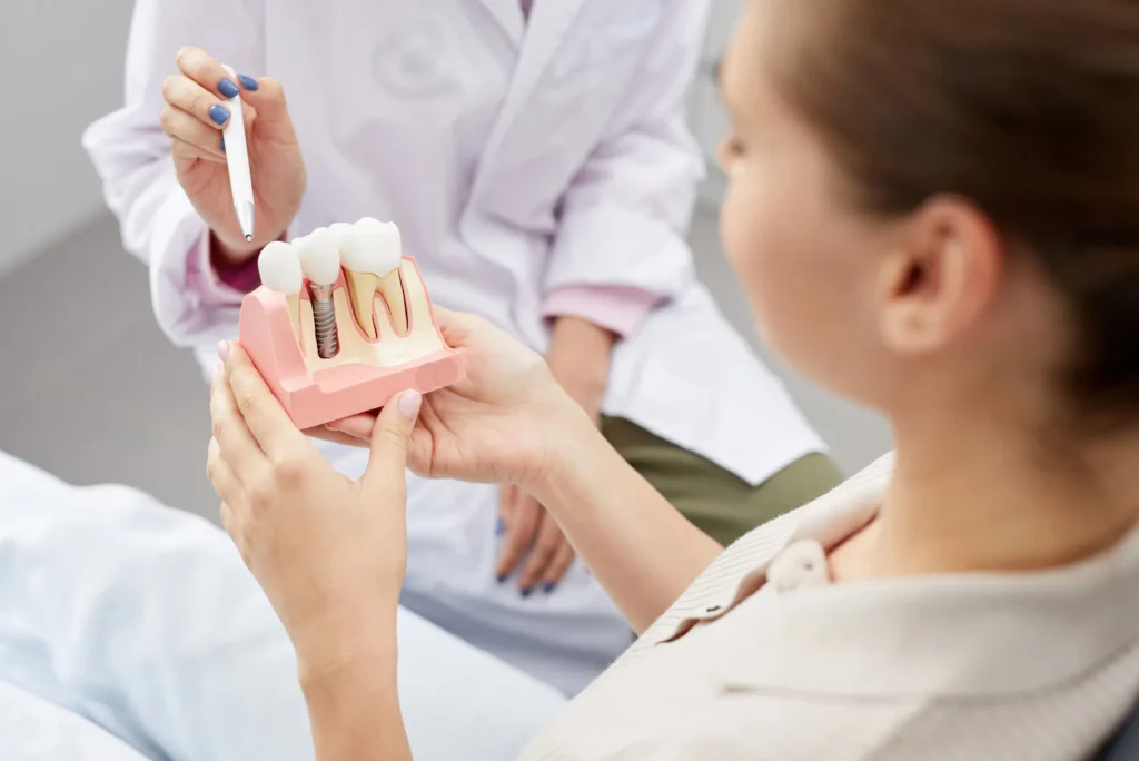 Dental Implants in Dubai