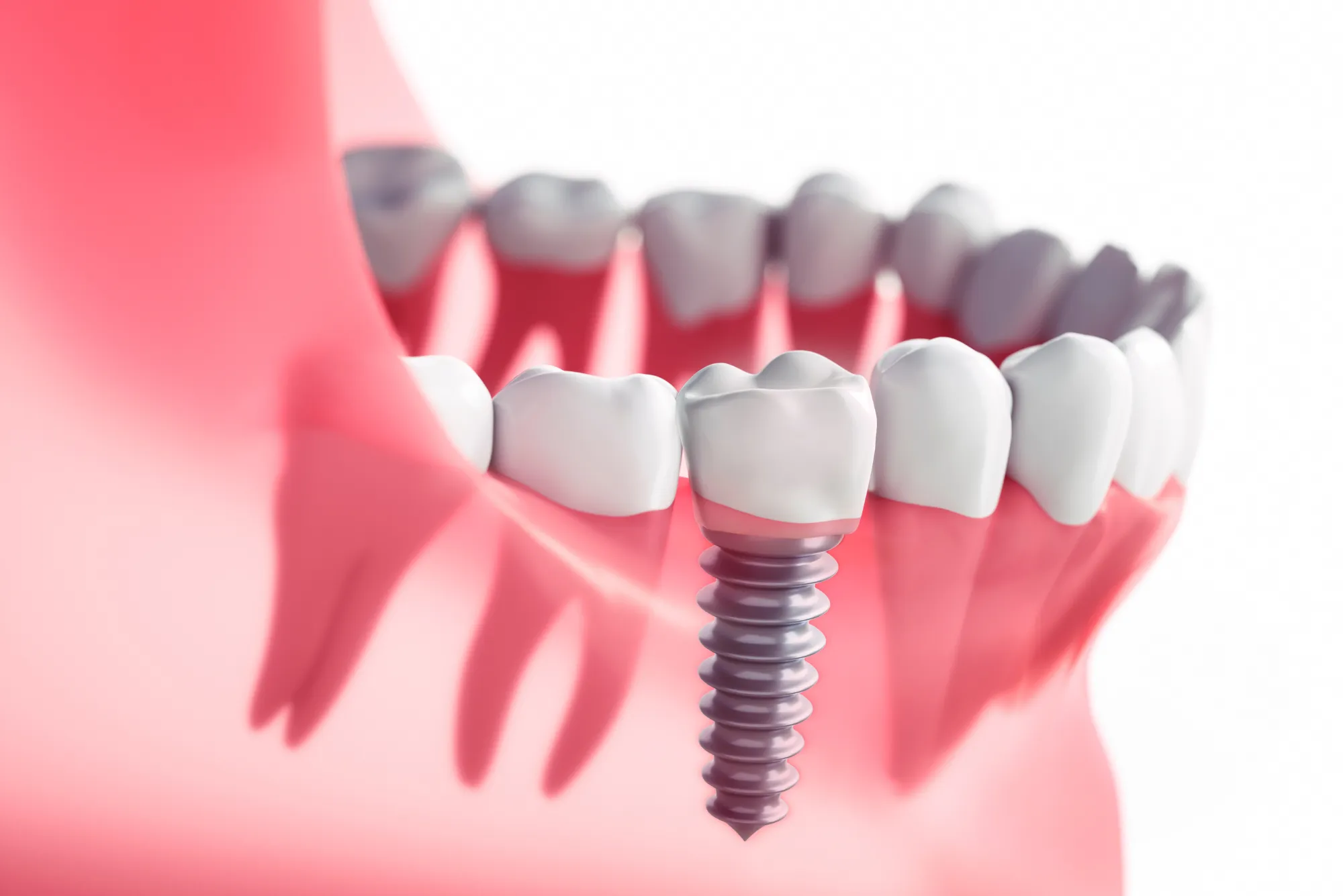 Best Pediatric Dentist Umm Suqeim 2 Kids Dental Care